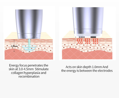 Snowland Powerful Portable I Cool Plus Ultrasonic Korean Face Lifting Wrinkle Removal Cooling Beauty Device