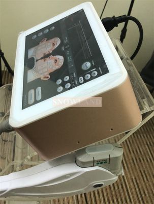 HOT! portable mini HIFU 4MHz&7Mhz skin machine/wireless hifu face lift beauty device for sale