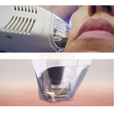 Tixel thermal fractional for scar /acne removal skin rejuvenation machine