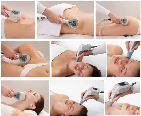 2023 New Popular Exilis Elite Rf Body Tightening Machine Face Lifting Ultra 360 Femme Machine For Beauty Salon Use