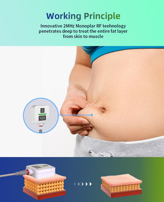 Standing New Design TruSculpt ID Trushape Id Deep Monopolar Rf Technology Weight Loss Fat Burning Weight Loss Machine