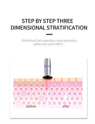 Snowland Powerful Portable I Cool Plus Ultrasonic Korean Face Lifting Wrinkle Removal Cooling Beauty Device